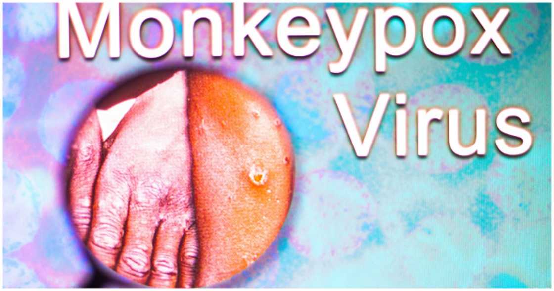 Monkeypox image Monkeypox image