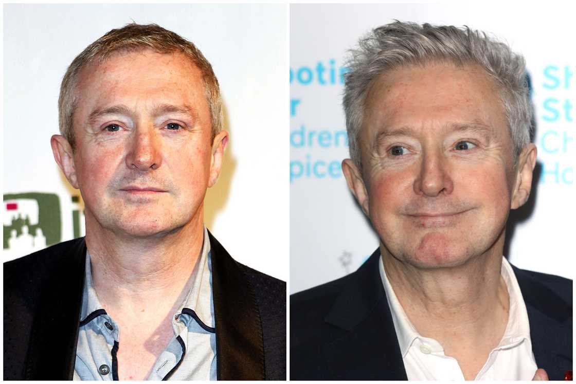 Hair transplant celebrities before and after Hair transplant celebrities before and after