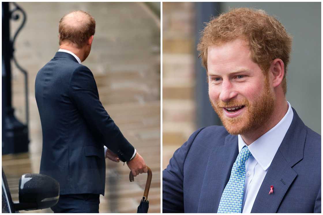 Hair transplant celebrities before and after Hair transplant celebrities before and after