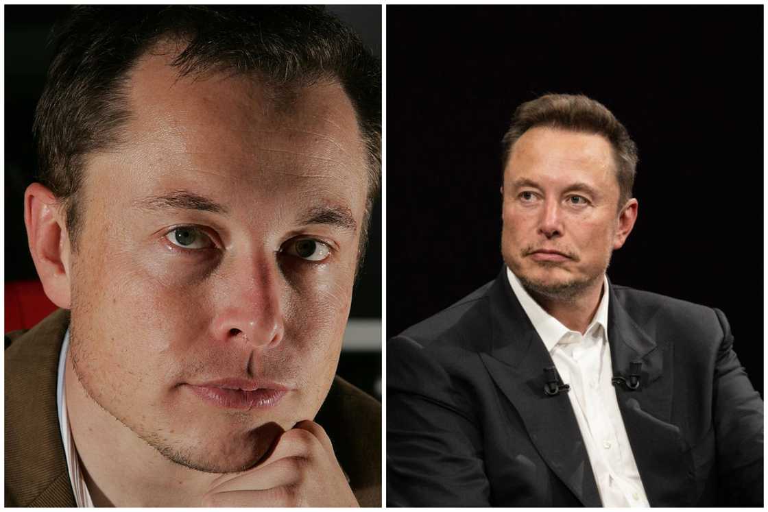 Hair transplant celebrities before and after Hair transplant celebrities before and after