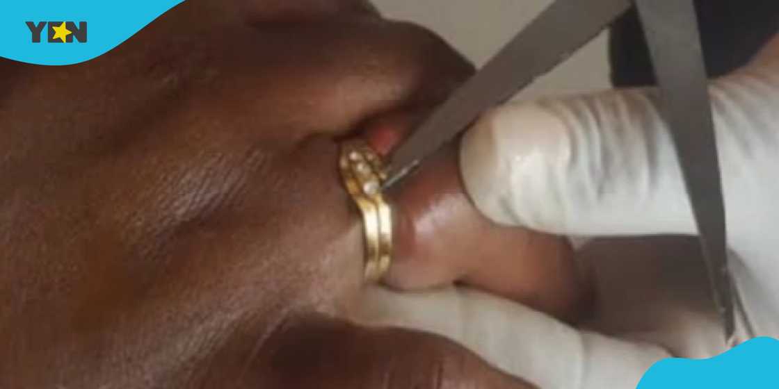 Faustina almost lost her ring finger after a ring she bought from a friend got stuck on her hand.