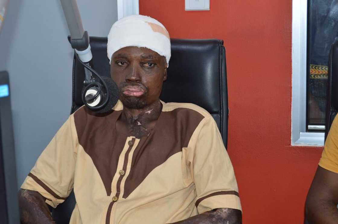 A man wearing a bandage around his head A man wearing a bandage around his head