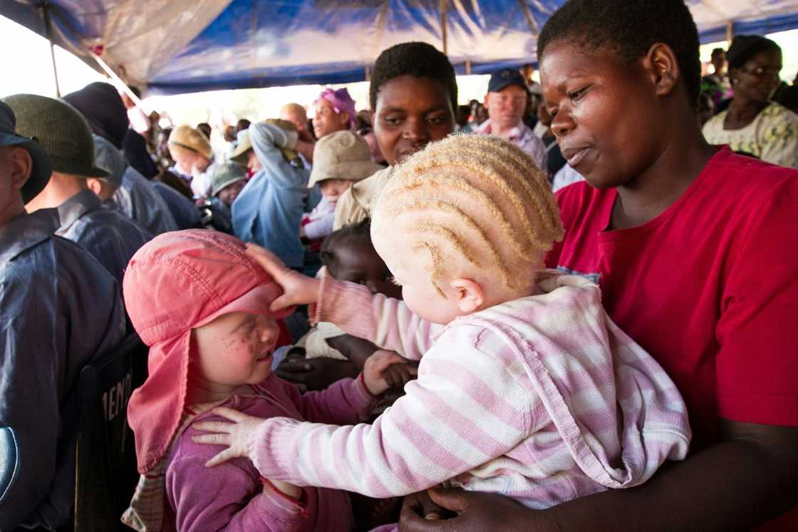 In some parts of Africa, people with albinism run the gauntlet of discrimination and even murder. Picture: children at an albinism awareness event in Malawi in 2015 In some parts of Africa, people with albinism run the gauntlet of discrimination and even murder. Picture: children at an albinism awareness event in Malawi in 2015