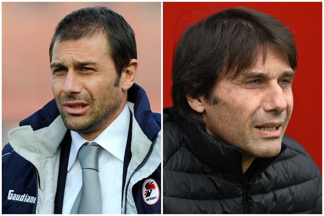 Hair transplant celebrities before and after Hair transplant celebrities before and after