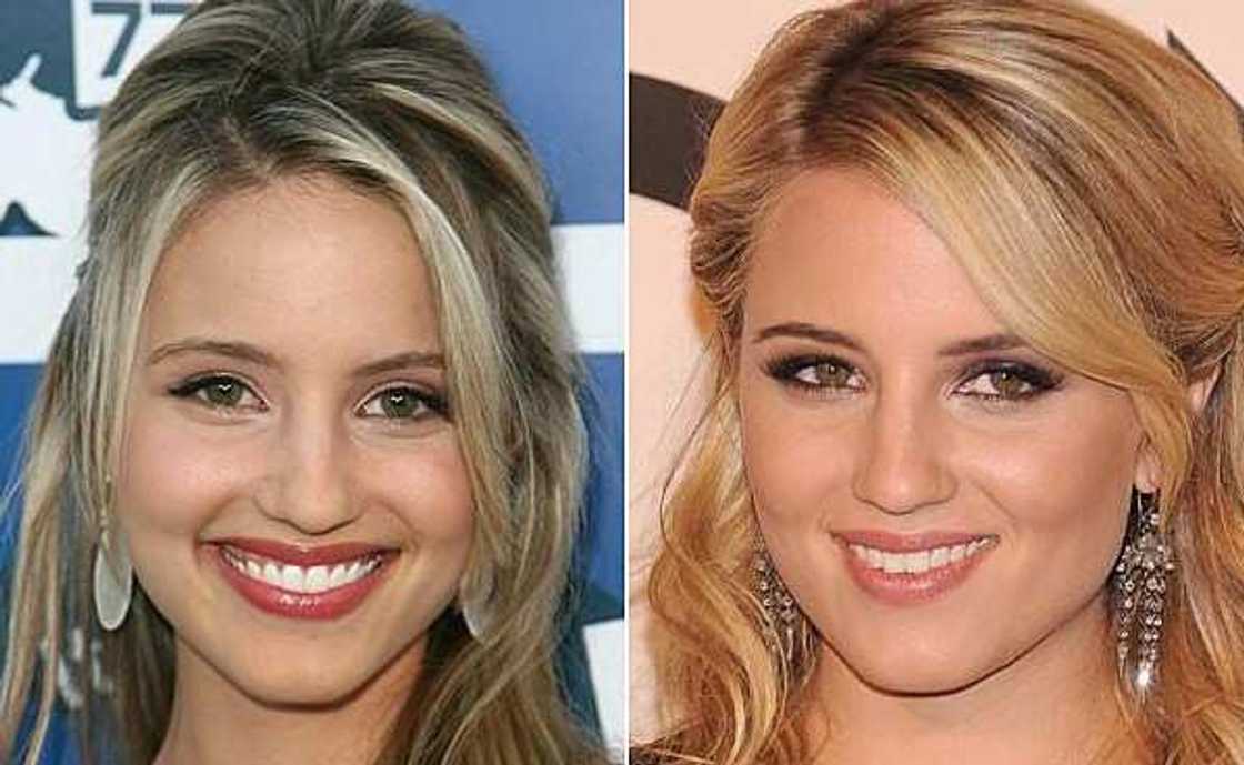 Celebrity nose jobs Celebrity nose jobs