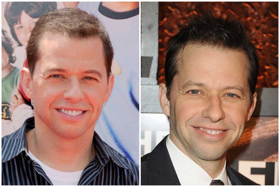 Hair transplant celebrities before and after Hair transplant celebrities before and after