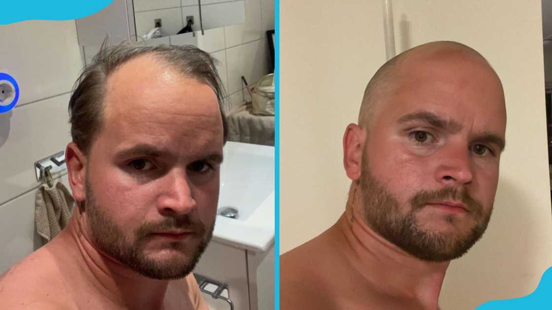 Balding buzz cut Balding buzz cut