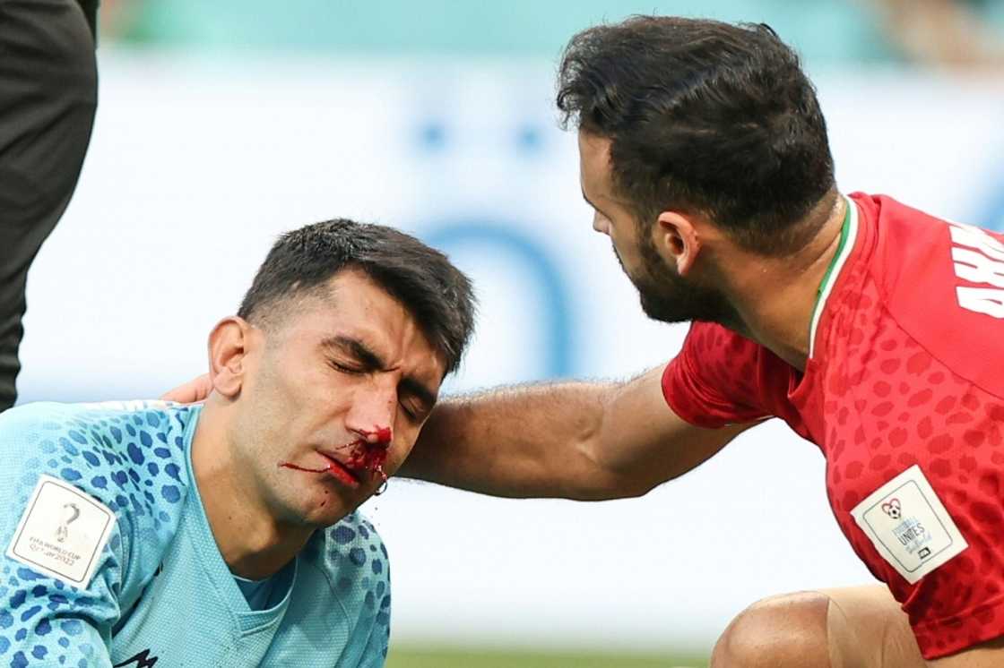Iran's goalkeeper Alireza Beiranvand suffered a broken nose in the England match Iran's goalkeeper Alireza Beiranvand suffered a broken nose in the England match