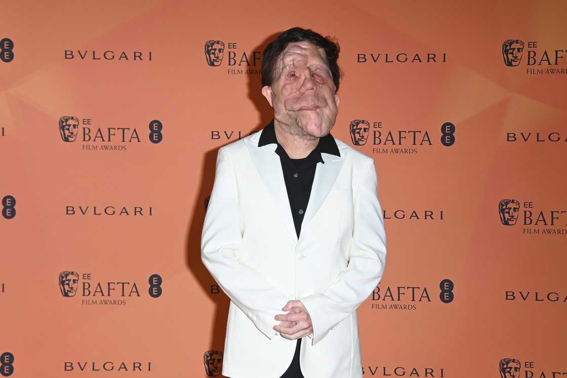 Adam Pearson attends the Nominees' Party for the EE BAFTA Film Awards 2025 in London, England. Adam Pearson attends the Nominees' Party for the EE BAFTA Film Awards 2025 in London, England.