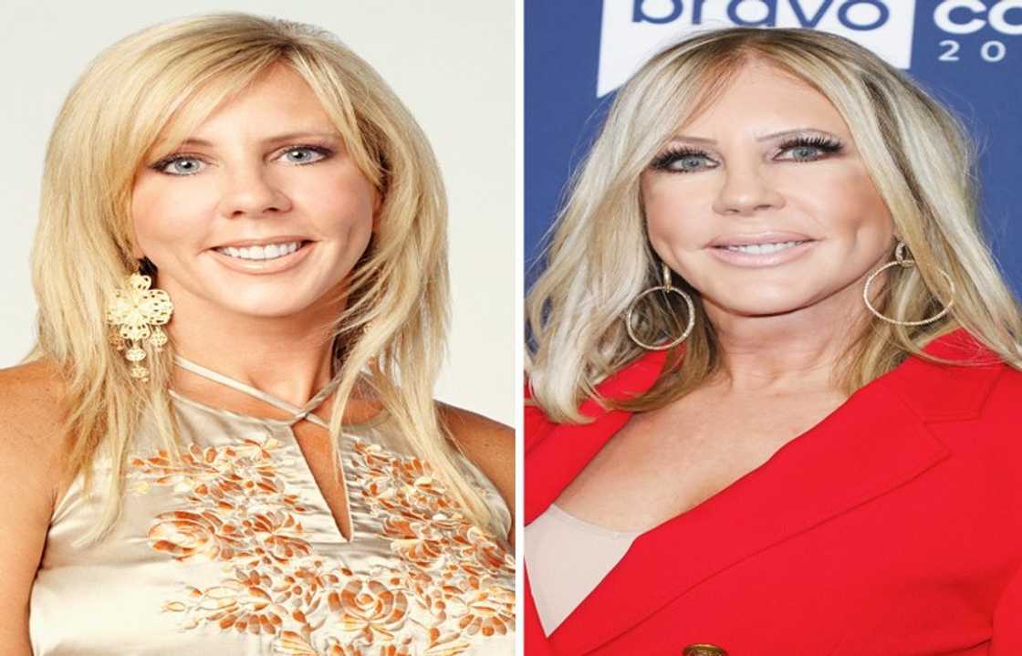 Celebrity nose jobs Celebrity nose jobs