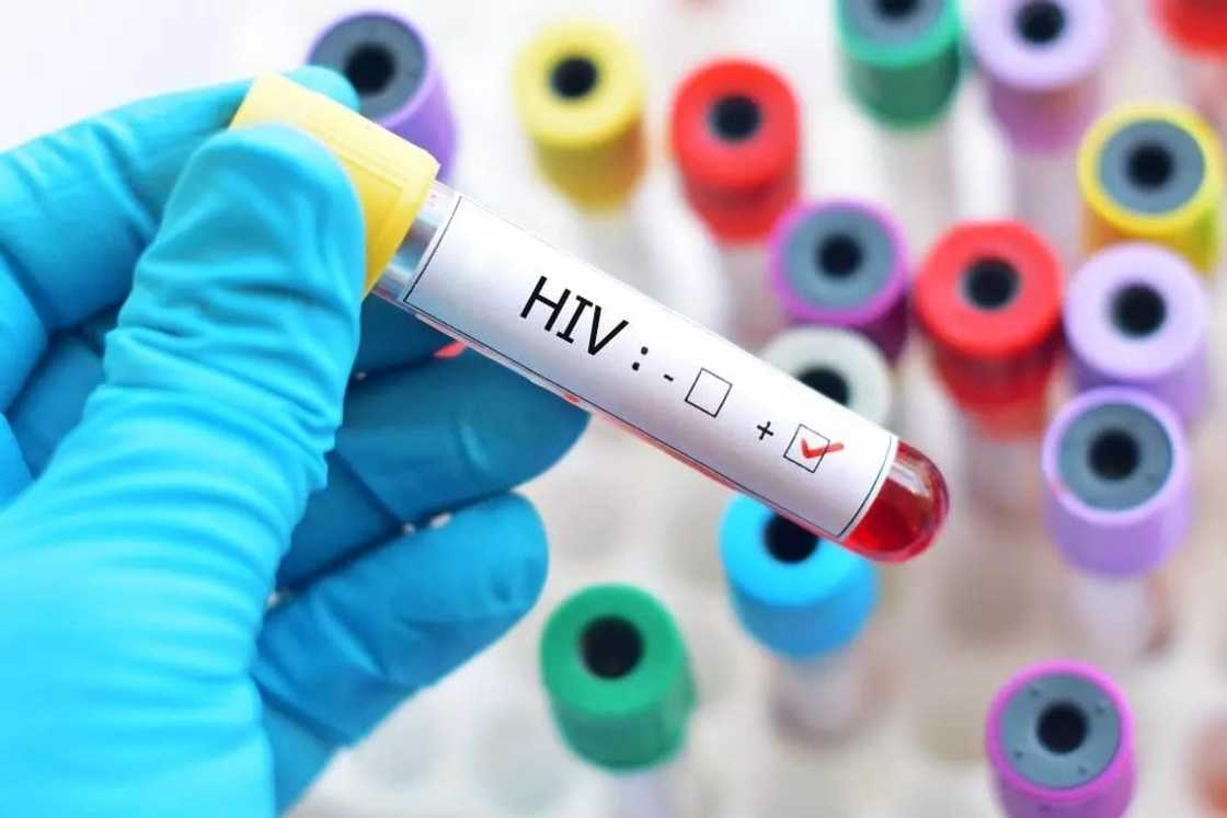 HIV Aids Test Tube