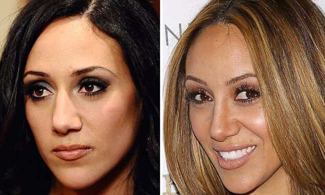 Celebrity nose jobs Celebrity nose jobs