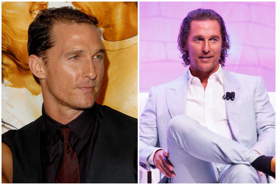 Hair transplant celebrities before and after Hair transplant celebrities before and after