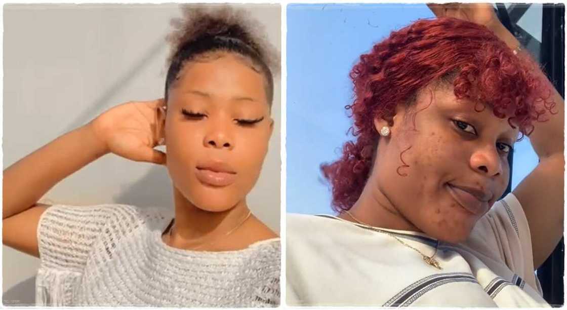 Photos of a Nigerian lady who suffered a skin damage in Canada. Photos of a Nigerian lady who suffered a skin damage in Canada.