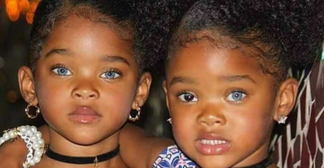 Gorgeous twins with unique eyes