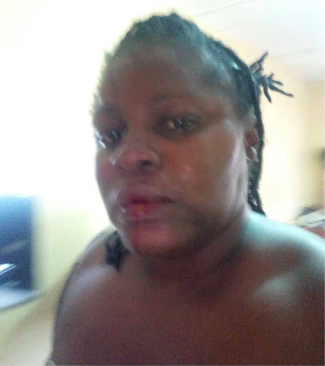 Abused former wife of former news editor of Joy FM and Citi FM tells story and shares photos Abused former wife of former news editor of Joy FM and Citi FM tells story and shares photos