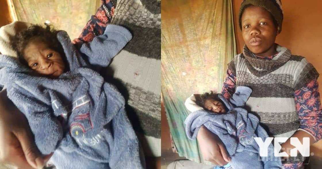 mother, devastated, child, progeria mother, devastated, child, progeria