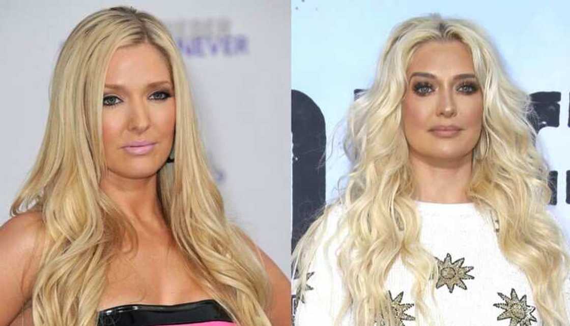 Celebrity nose jobs Celebrity nose jobs