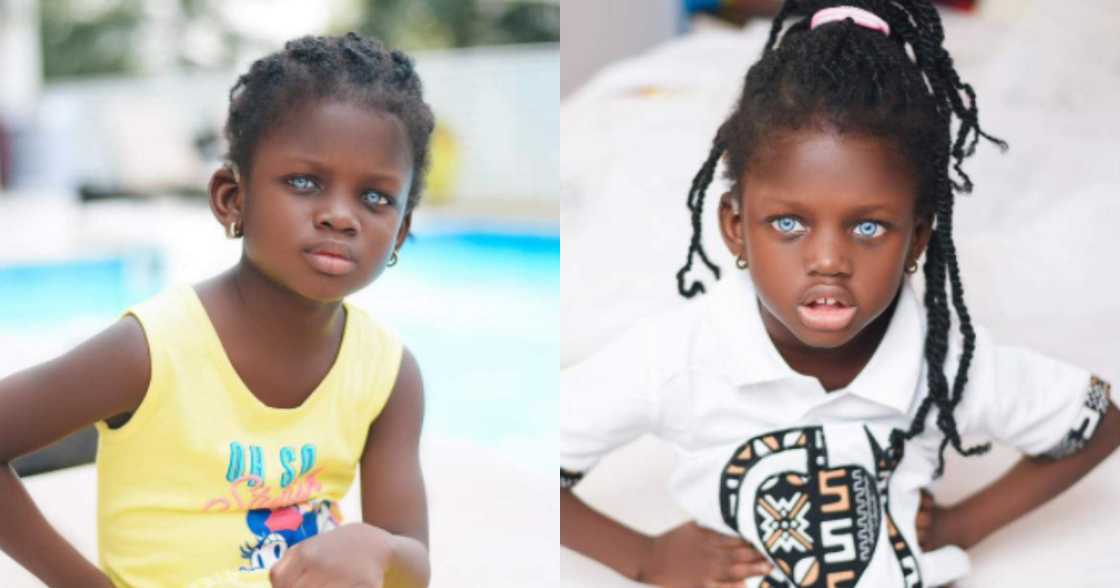 Rebecca Dumeh: Blue-eyed child modelling to raise funds and awareness for her condition Rebecca Dumeh: Blue-eyed child modelling to raise funds and awareness for her condition