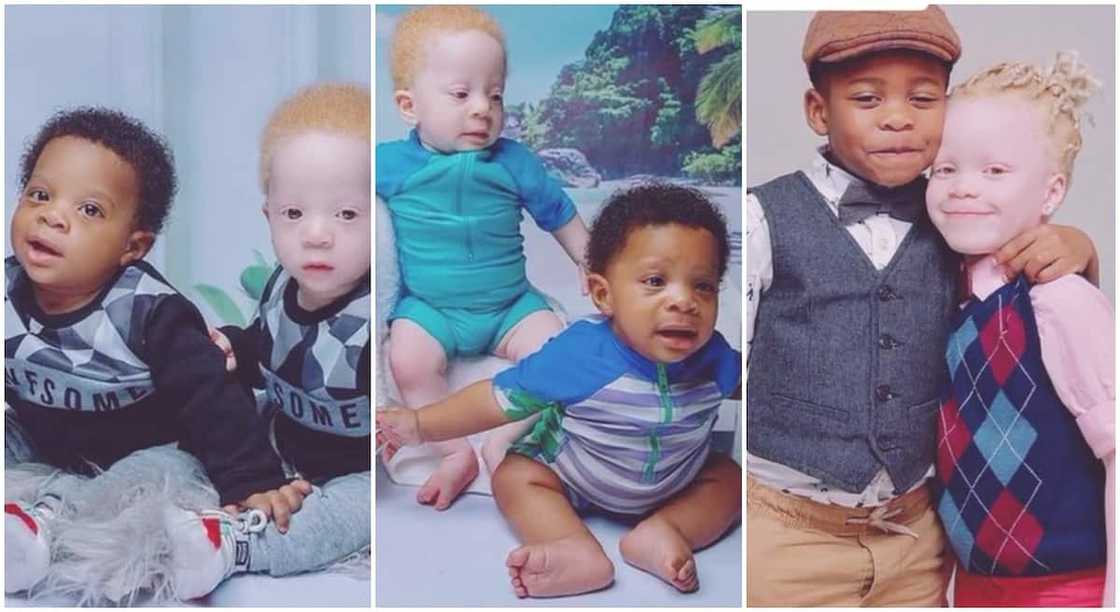 Photos of rare twins, one albino, one black.