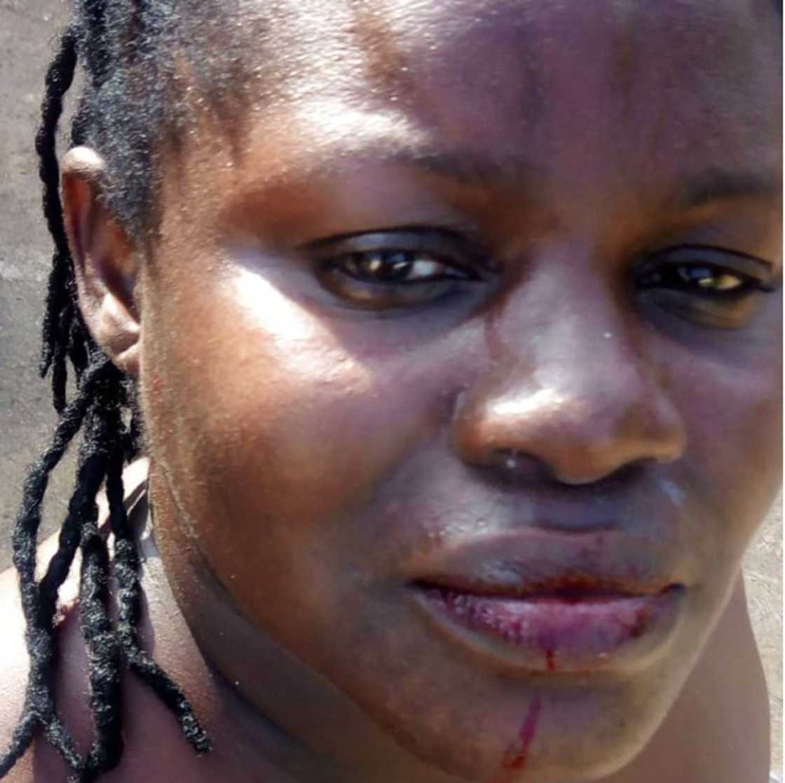 Abused former wife of former news editor of Joy FM and Citi FM tells story and shares photos Abused former wife of former news editor of Joy FM and Citi FM tells story and shares photos