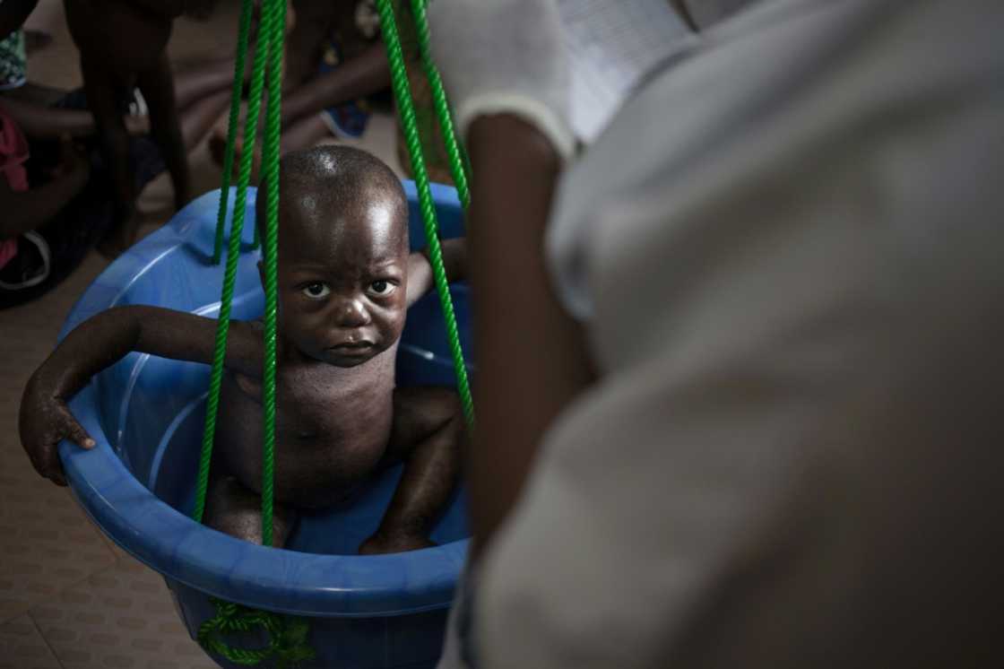 Hunger: A child is weighed at a CAR malnutrition unit Hunger: A child is weighed at a CAR malnutrition unit