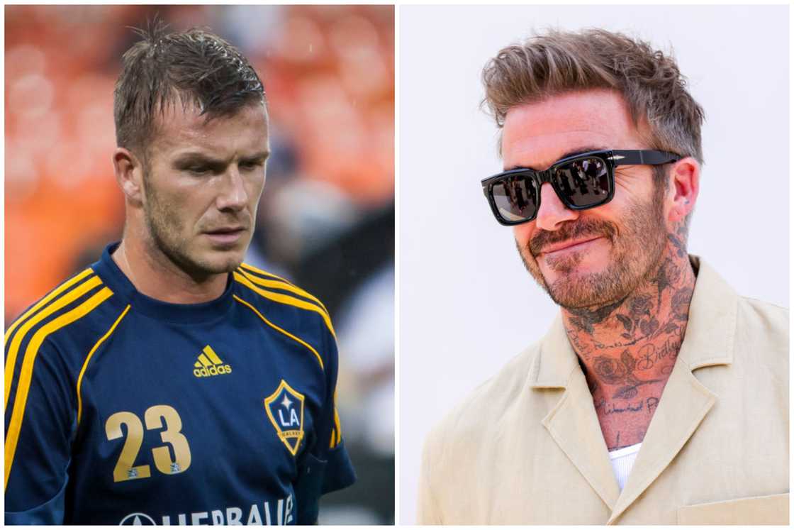 Hair transplant celebrities before and after Hair transplant celebrities before and after