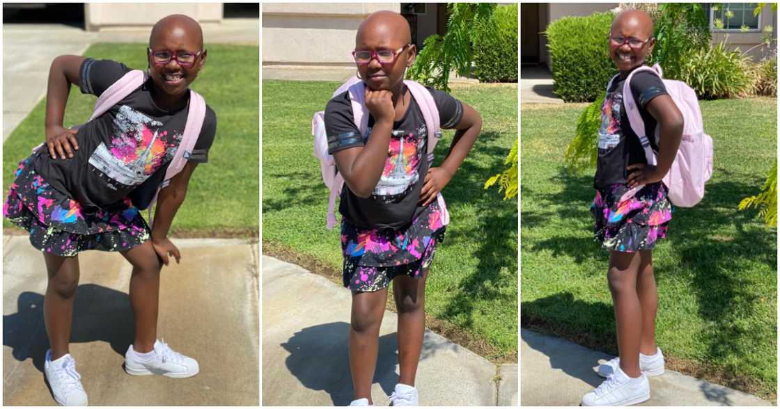 Girls with alopecia flexes her confidence. Girls with alopecia flexes her confidence.