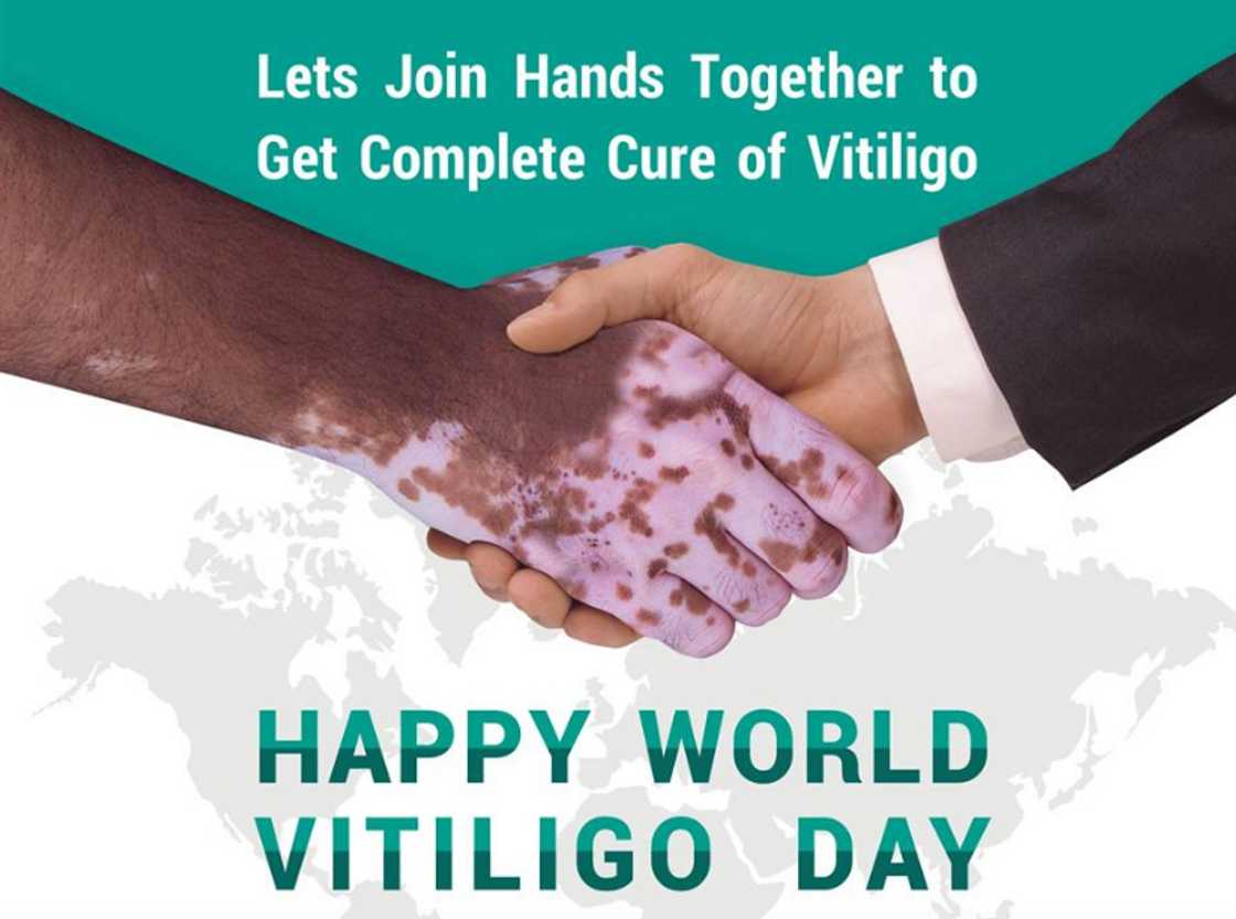 Vitiligo Day Vitiligo Day