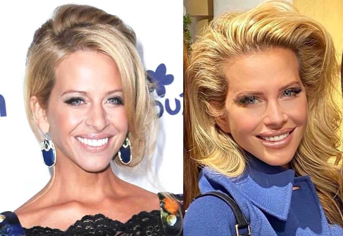 Celebrity nose jobs Celebrity nose jobs