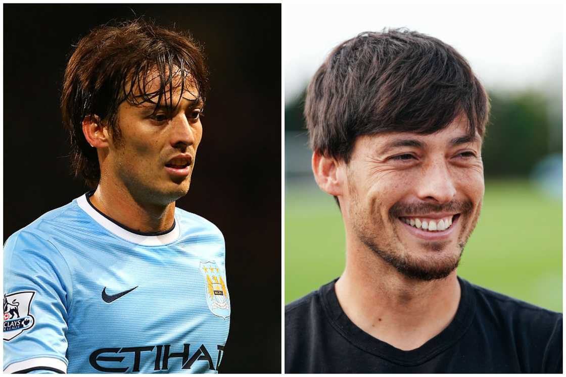 Hair transplant celebrities before and after Hair transplant celebrities before and after