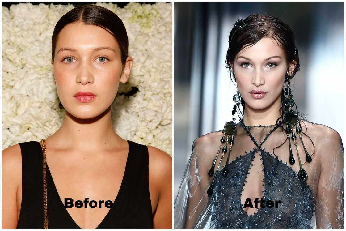 bella hadid's plastic surgeries before and after bella hadid's plastic surgeries before and after