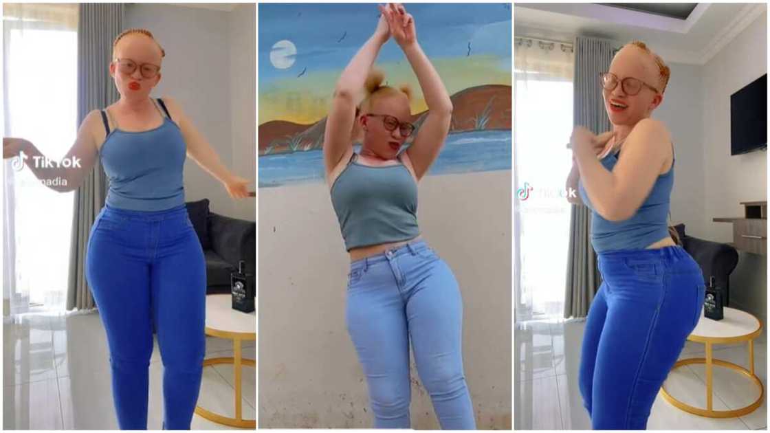 Albino girl with skin colour/Lady danced in video.