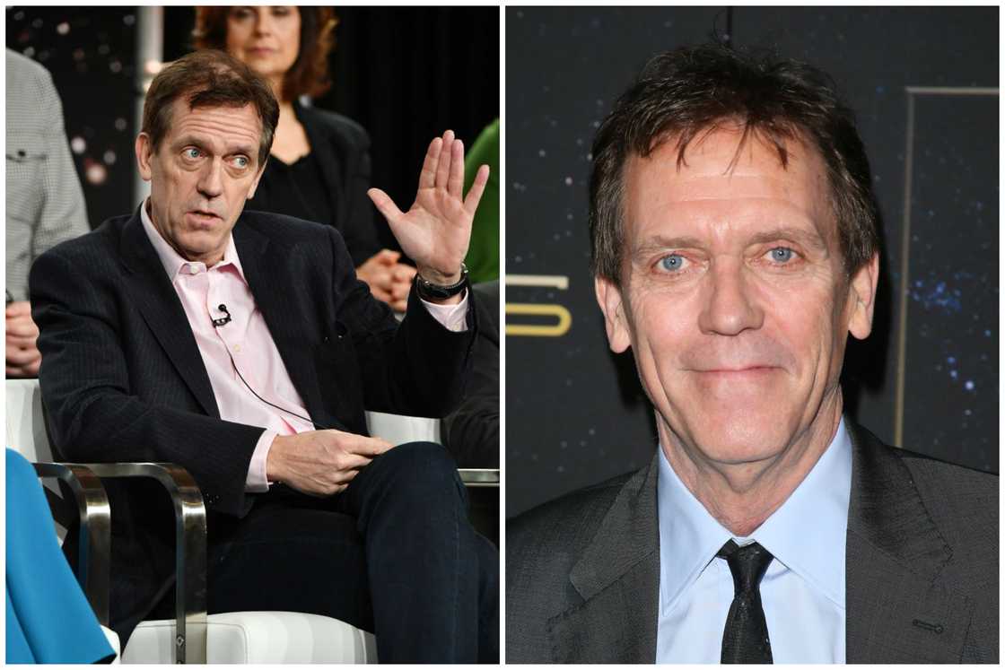 Hair transplant celebrities before and after Hair transplant celebrities before and after