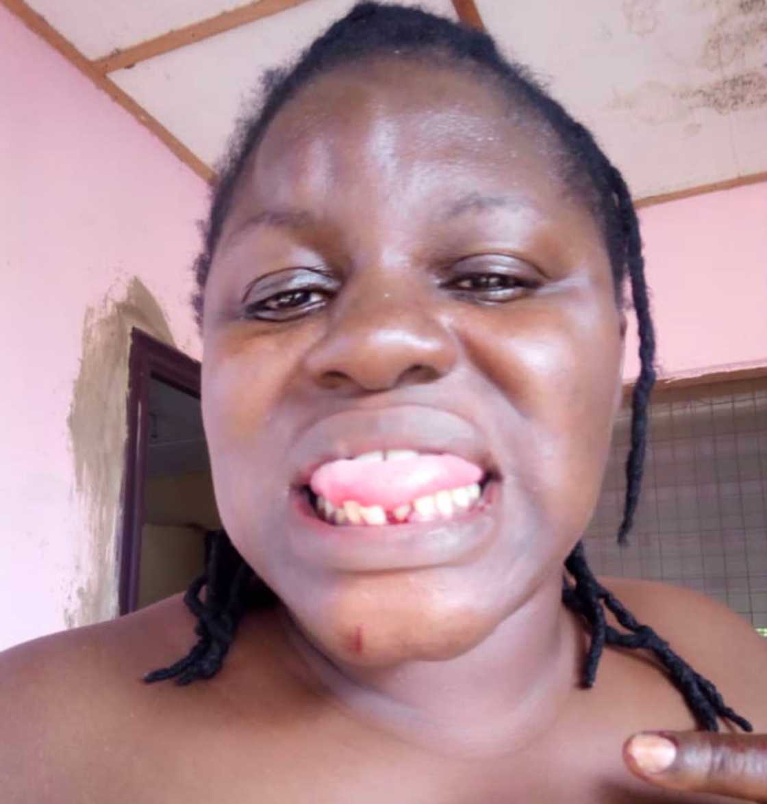 Abused former wife of former news editor of Joy FM and Citi FM tells story and shares photos Abused former wife of former news editor of Joy FM and Citi FM tells story and shares photos