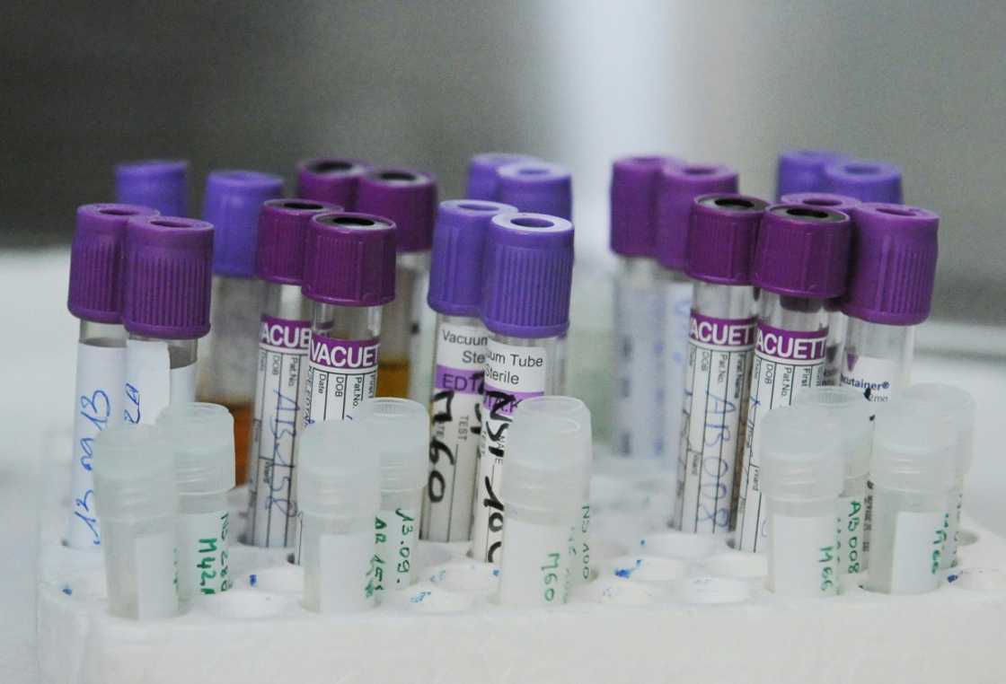 Blood samples taken in 2013 as part of a Unitaid-funded project to better survey people living with HIV in Abidjan, Ivory Coast