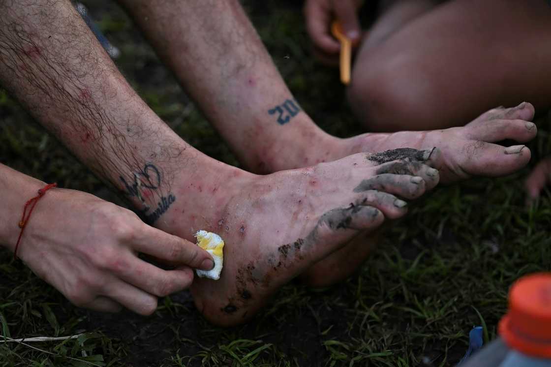 A man tends to his injuries at Canaan Membrillo village in Panama's Darien Jungle on October 12, 2022