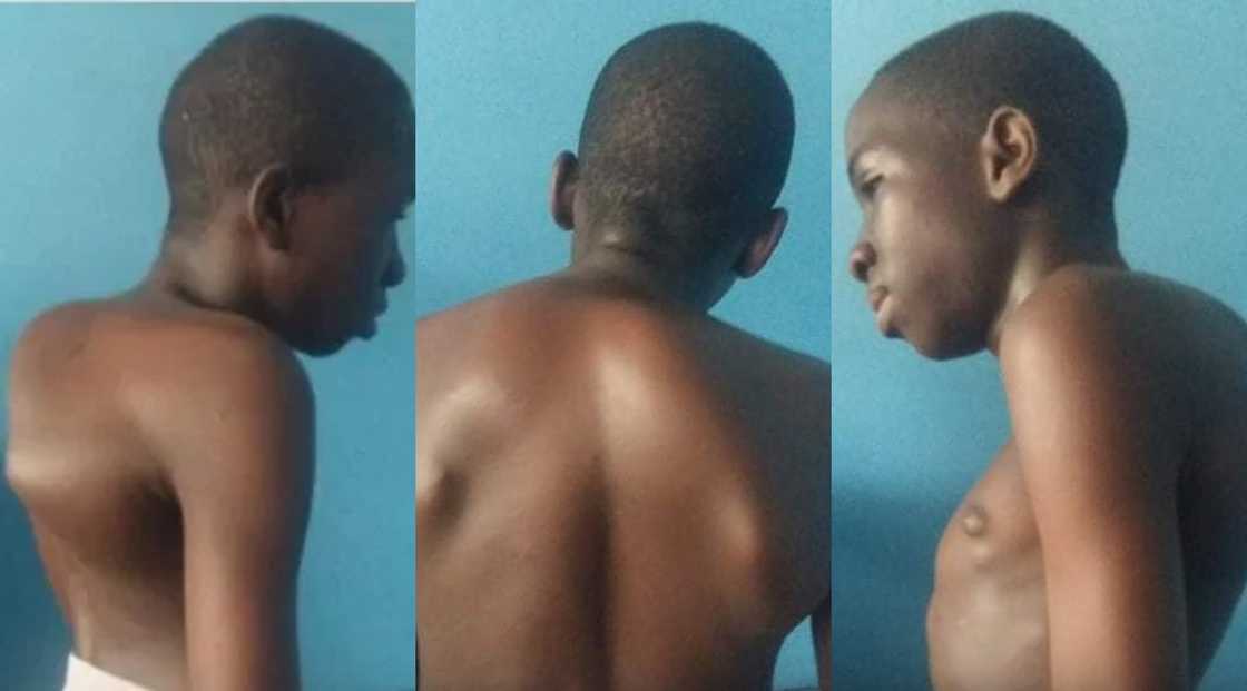 Daniel Asante: 14-year-old appeals for over GHC75k for urgent spine surgery (photos)