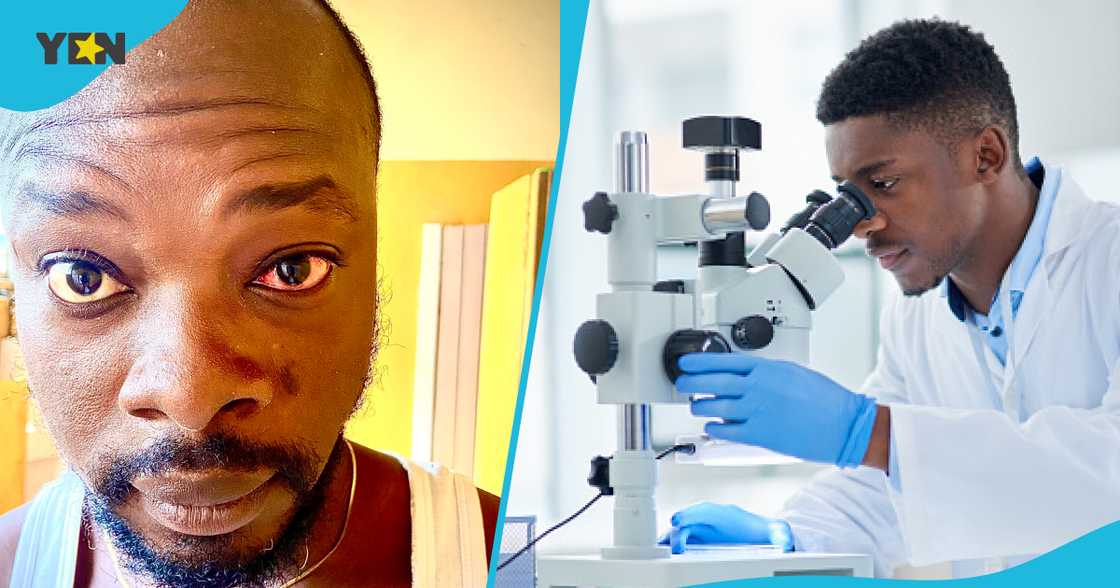 'Apollo' Cases: Ghanaians Cautioned About Fast-Spreading Of Acute Hemorrhagic Conjunctivitis In Ghana 'Apollo' Cases: Ghanaians Cautioned About Fast-Spreading Of Acute Hemorrhagic Conjunctivitis In Ghana