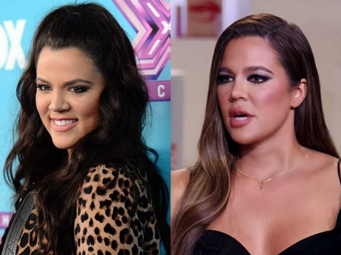 Celebrity nose jobs Celebrity nose jobs