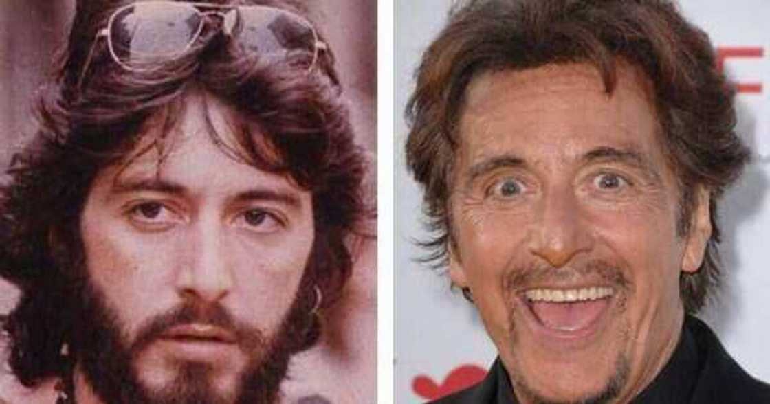 Celebrity blepharoplasty before and after Celebrity blepharoplasty before and after