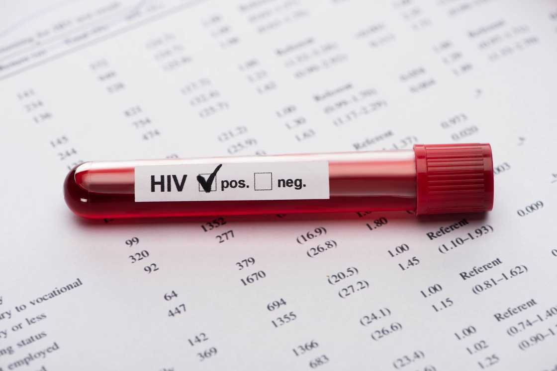 HIV positive test results
