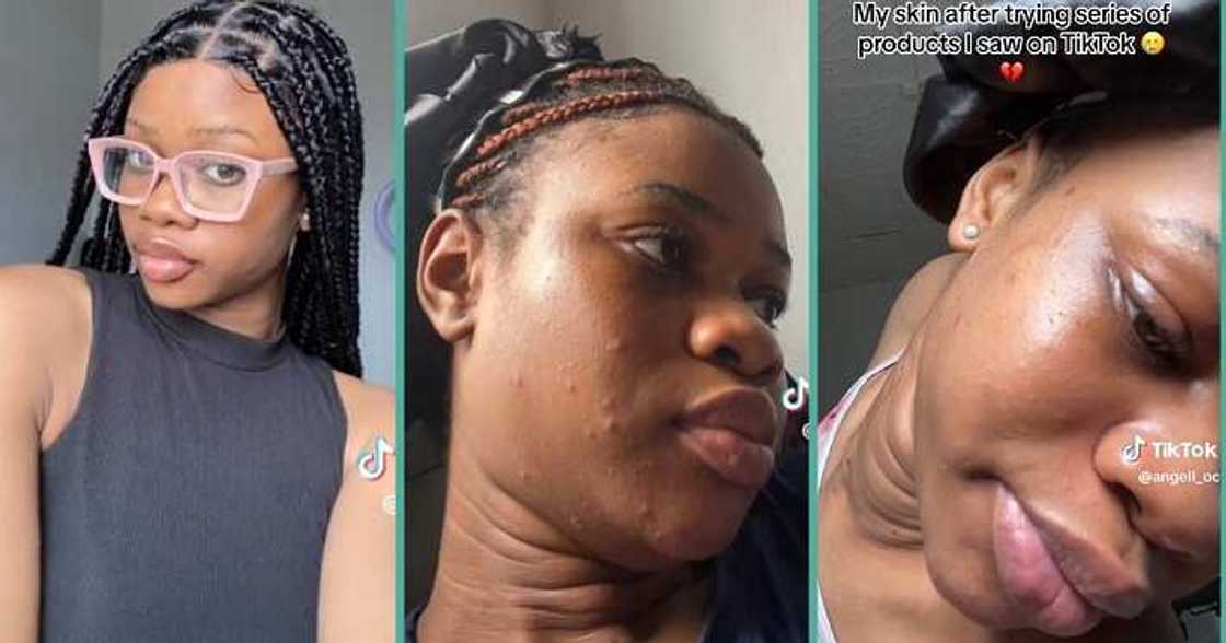 Lady laments over rough skin after joining skincare trend Lady laments over rough skin after joining skincare trend