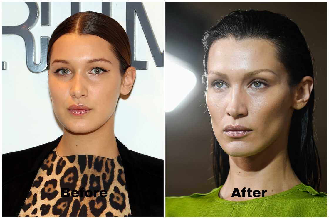 Bella Hadid before and after Bella Hadid before and after