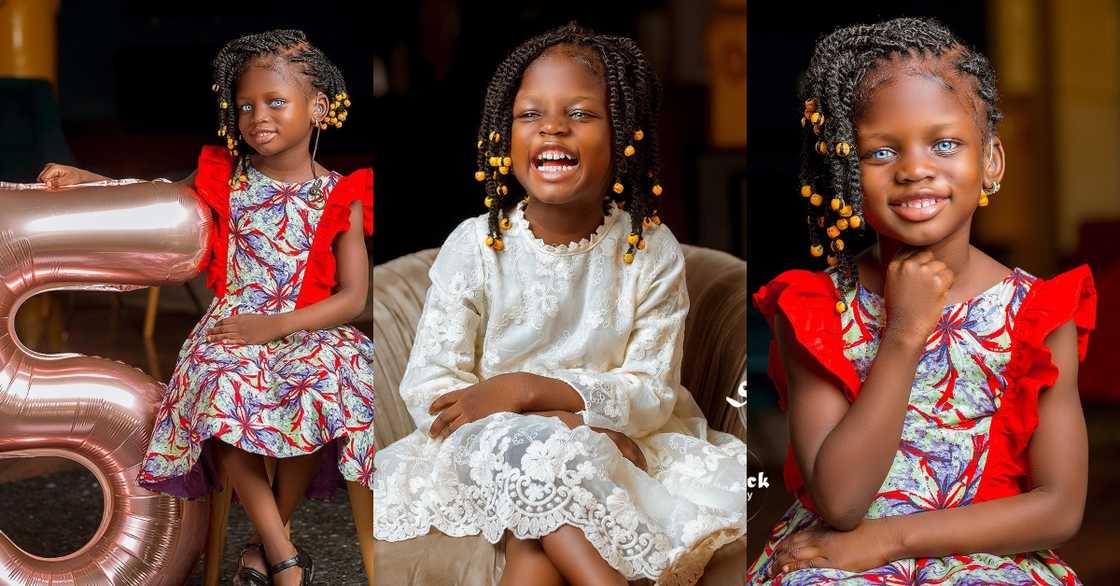 Chogtaa: Ghanaian girl & model in need of surgery celebrates 5th birthday in stunning photos