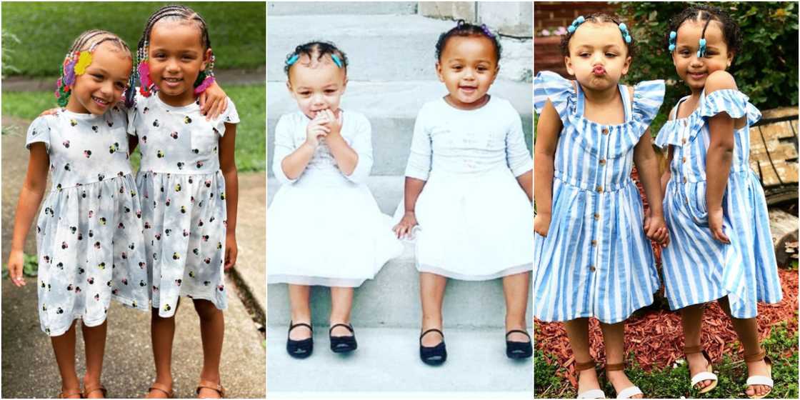 Kalani and Jarani: 5 photos of the twin sisters born with rare black and white skin colours Kalani and Jarani: 5 photos of the twin sisters born with rare black and white skin colours