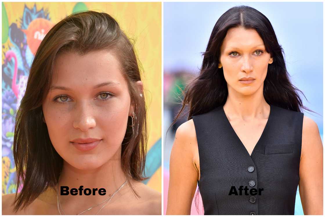Bella Hadid before and after Bella Hadid before and after