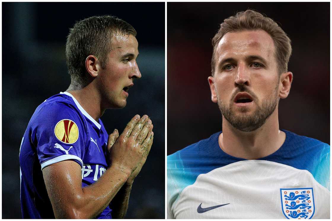 Hair transplant celebrities before and after Hair transplant celebrities before and after