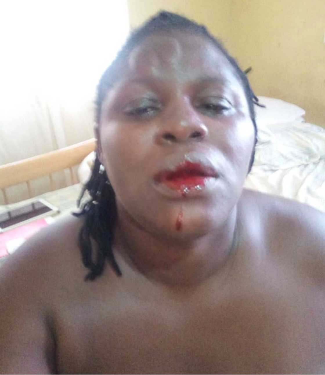 Abused former wife of former news editor of Joy FM and Citi FM tells story and shares photos Abused former wife of former news editor of Joy FM and Citi FM tells story and shares photos