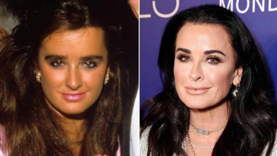 Celebrity nose jobs Celebrity nose jobs